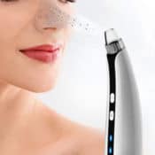 Amazon: Blackhead Remover Vacuum with 5 Replacement Probes $9.99 After...