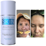 Amazon: 2% Hydroquinone Dark Spot Corrector Remover For Face & Melasma...